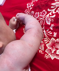 ��ҽ�����Ҽұ���5����20�죬�����һ��