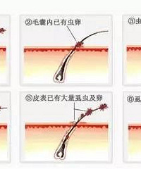 ���£�5��Ůͯ�Ͼ����۾��� ������Ƥ���ֳ����������������