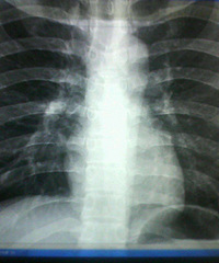 ����12�·ݵ�λ����Ĺ��ز�DR��λ �����ܻ�����