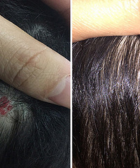 ����ͷƤ�ﳤ�˺�ɫ��ӡ�� Ѫ������