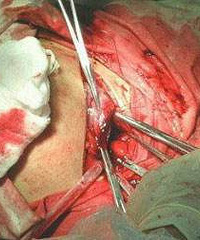 ��ʹ13Сʱ����ȫ������˳ת��...���ѣ��������