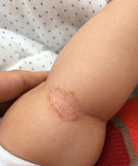 �����������£��ֱ۹ؽڴ�����һԪӲ�Ҵ�С�ĺ���