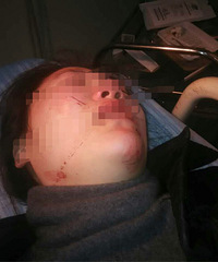 �Ҳ��̶ã�����28��Ů������·�� ����������ĸֽ��������