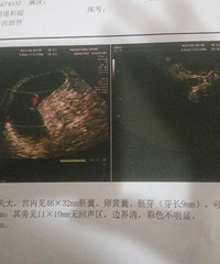 ̥��̥ѿ������ ��Ҫ�Ա�̥ҩ?