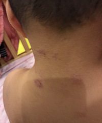 ��ҽ��������ʲô���Լ���������i���ü���