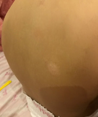 ��ҽ��������ʲô���Լ���������i���ü���