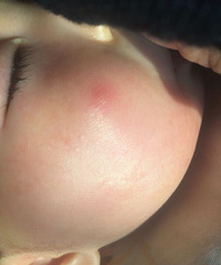 �������Ϻ��