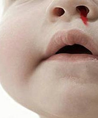 14���´󱦱�����Ѫ ���ϻ��ԭ��