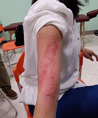 6��Ů����������� �������˺ܶ�Ѫ��...