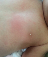 ��ҽ��������54�촿ĸ��ι����2���鷿��