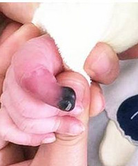 4��Ů�������Ҫ��ָ��ҽ���������ܵð�Ѫ��