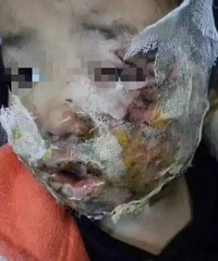 �����ֻ���ը�ˣ�5��Ůͯ������ݣ�ȫ��Ϊ�������