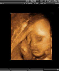 25W������άb�� �������һ����������� ��ȥ���ݸ���