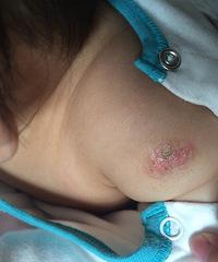 ��ҽ��������������λ���ã��ǲ���ʪ���ϵ����ʲô�취��