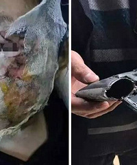 �����ֻ���ը�ˣ�5��Ůͯ������� ��