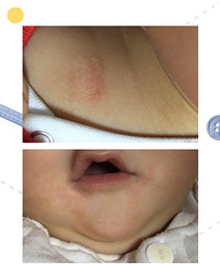 �����߸��£��粿�������������