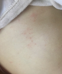 ��ҽ�����Ҷ��Ӷ����Ϻͱ��϶������ֺ���