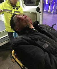 �ֲ�������һ���Ӻ������Ħ�г� ͻȻ��������