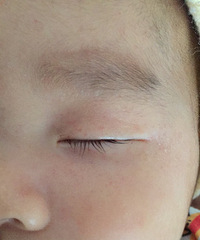 ��ҽ����������Щ������ʪ���ɶ����Ϊ֮