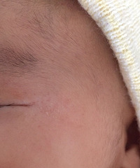 ��ҽ����������Щ������ʪ���ɶ����Ϊ֮