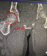 9���к�ˤ��һ��û���� �ڶ���һ�飬��Ȼ���ϡ��������ۡ�