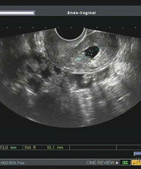 ����40���� �����޻����� ҽ�����鲻Ҫ�⺢�ӣ�