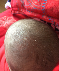 δ�����ӵı���Ƥ��ë�� �������˼���ҩ��һͣ�ͷ�����