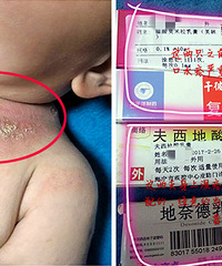 8�����±���ȫ��ʪ������ ��Ƥ��ˮ��