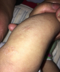 ҽ����������ʪ���������ֽ���ģ�ͬ����