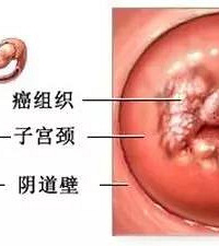 ׼���軳��18�� ȴͻȻ���ˡ��¾�������ҽһ�龹Ȼ�ǰ�֢��