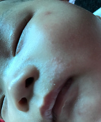 ����ʪ��������ѯ����ҽ�����лл����