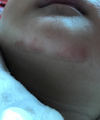 ����ʪ��������ѯ����ҽ�����лл����