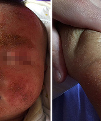 ����ʪ������ ����ˮ ͷƤ��Ҳ����