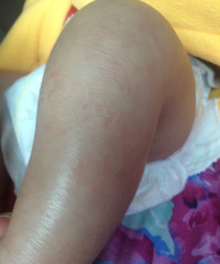 ��ҽ����������������ô��