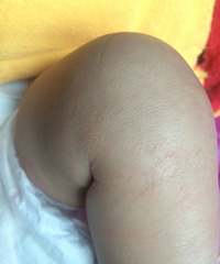 ��ҽ����������������ô��