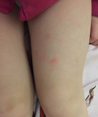 ��֫��������ô�죿