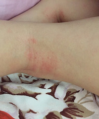 ��֫��������ô�죿