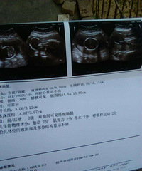 ��������˫��̥ �������ϱ������к��������Ҷ����գ�