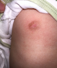 �Ƿ���ʪ�