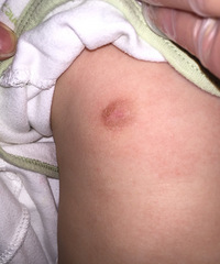 �Ƿ���ʪ�