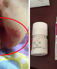 ������ƨ��2�������� ��֧ҩ��Ϳ�˲�����