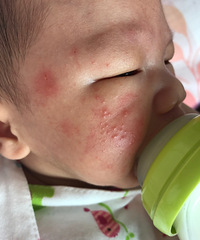 ��ҽ�����æ