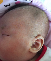 ��Ƥ ���� ���� ����ʪ������