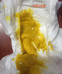 ������ǰϡ