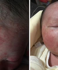 ʪ��������֧���� �������ˣ�