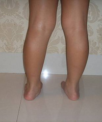 ������·���� 2�����ڰ����� ��Ҫ���Լ�������