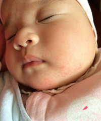 ��ҽ������æ����