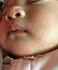 ��ҽ������æ����