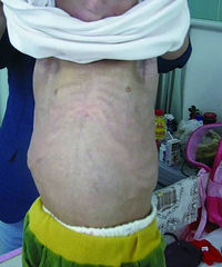 �죡11��Ů���ϵ���80�갢�ţ�ҽ������Ľ������̾Ϣ��