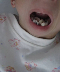 �죡11��Ů���ϵ���80�갢�ţ�ҽ������Ľ������̾Ϣ��